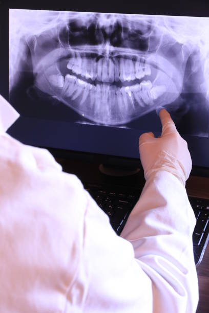Best Emergency Dental Care for Abscessed Tooth in Brownsville, TX